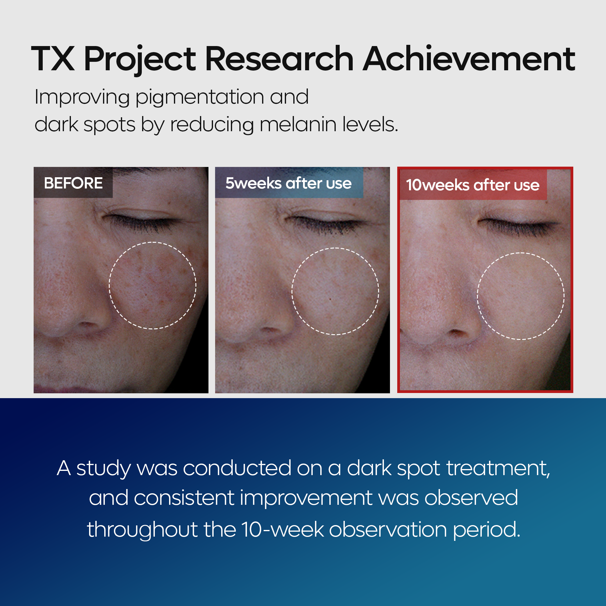 TX Tranexamic Acid Dark Spot Tone Care Line