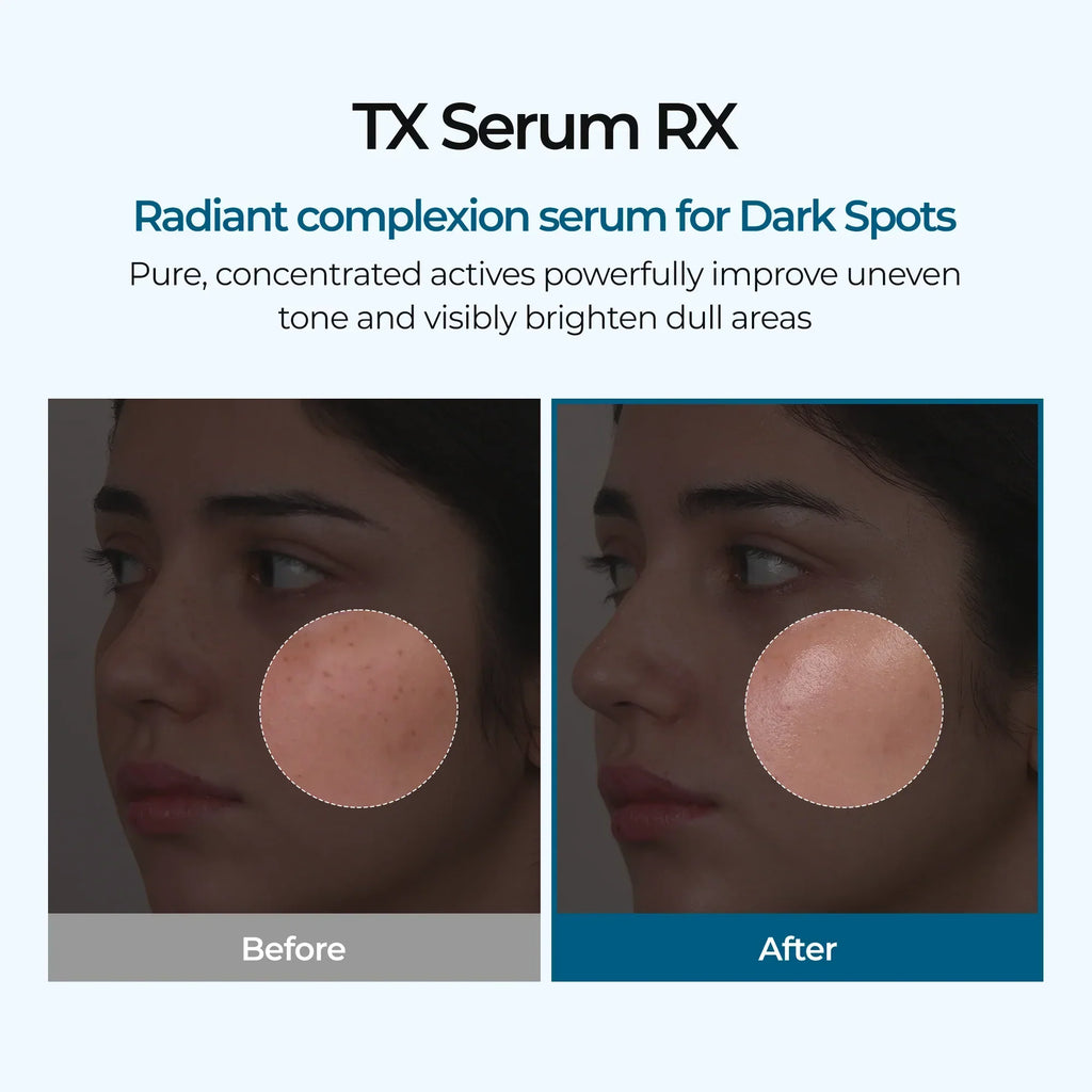 TX Ampoule Rx