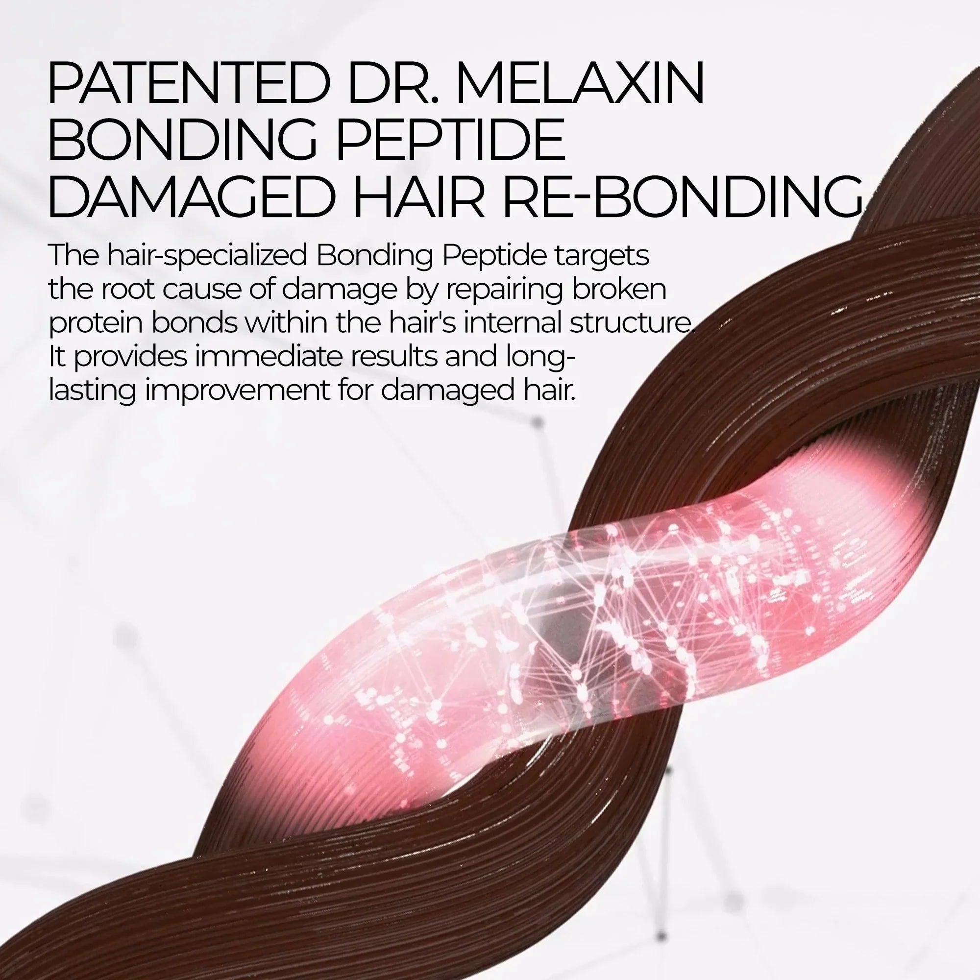 Bondex bonding remodeling line