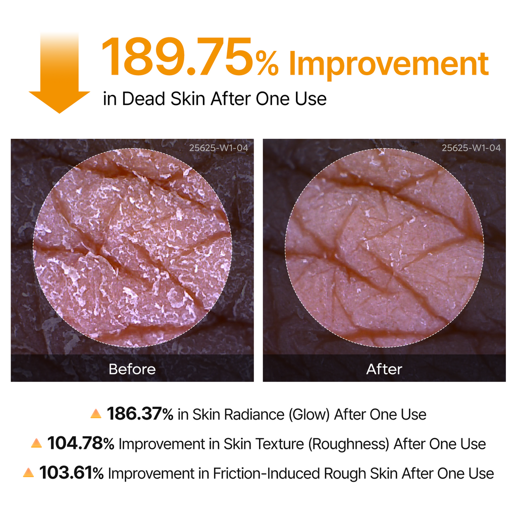Peel Shot Complete Care Set