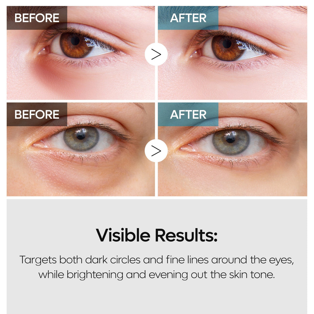 TX-Retinalsome Double Effect Eyecream